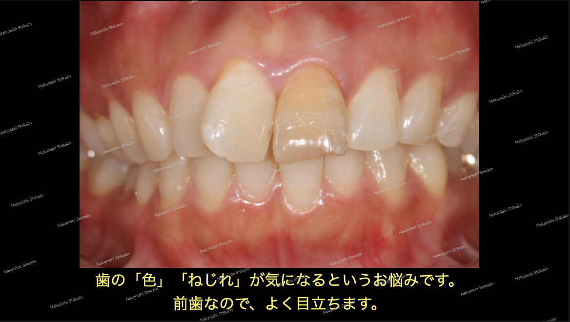 ブログ｜津市久居の歯医者｜ナカニシ歯科医院