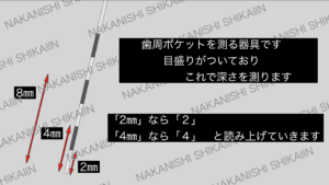 歯周ポケットを測定する器具です
