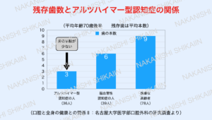 残っている歯の数とアルツハイマー型認知症の関係。認知症の人はそうでない人と比べて歯の数が少ない。