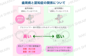歯周病と認知症の関係について。ネズミの実験では、歯周病に罹患しているマウスの方がアルツハイマーの原因タンパク質Aβの蓄積が多い