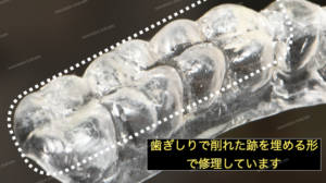 歯ぎしりで削れたマウスピースを修理しています２
