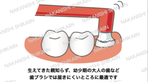 ワンタフトブラシは生えかけている歯の清掃に良いです