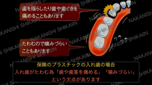 保険のプラスチックの入れ歯はたわむ為、歯や歯茎を痛める、噛みにくいことがあります