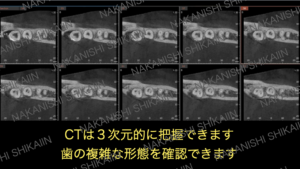 樋状根の形態が確認できます