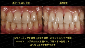 ブログ｜津市久居の歯医者｜ナカニシ歯科医院