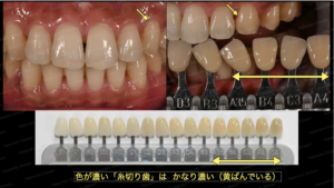ブログ｜津市久居の歯医者｜ナカニシ歯科医院
